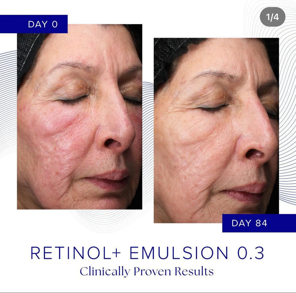 Retinol Is Clinical