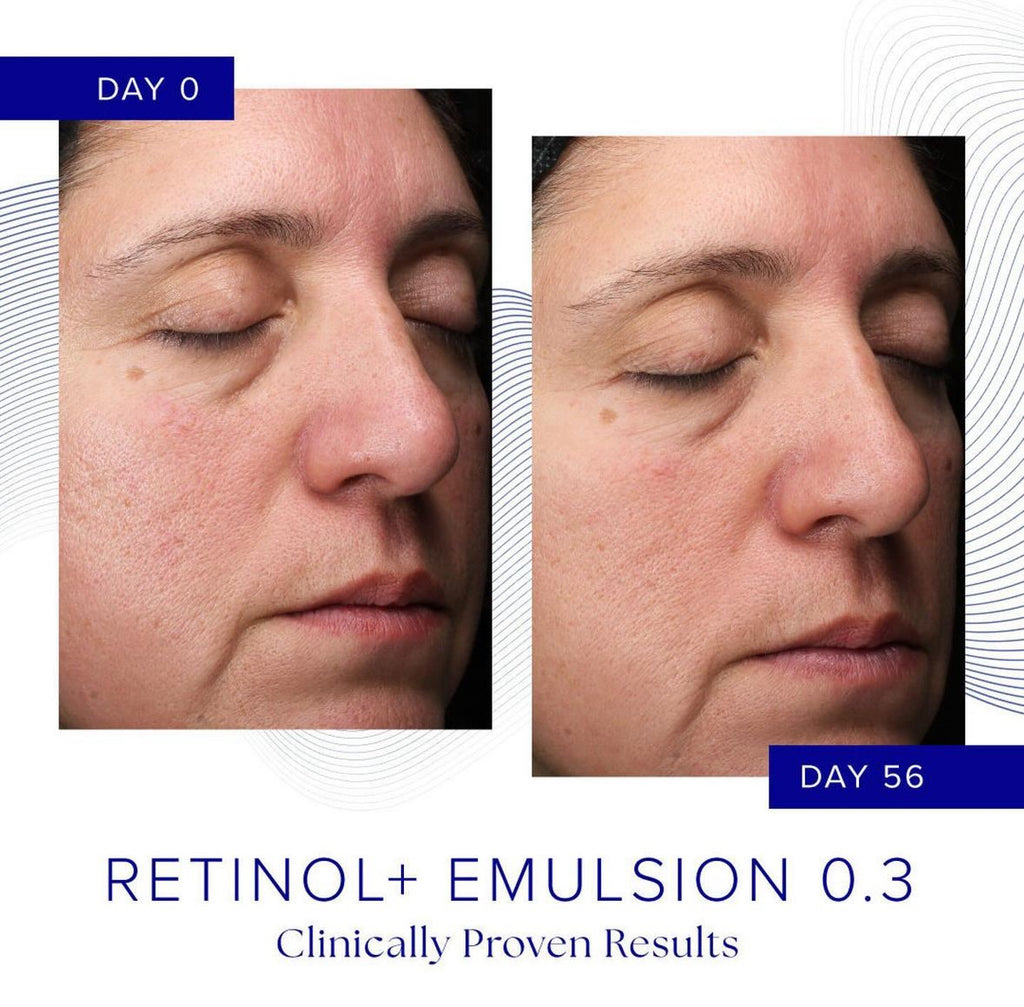 Retinol Is Clinical