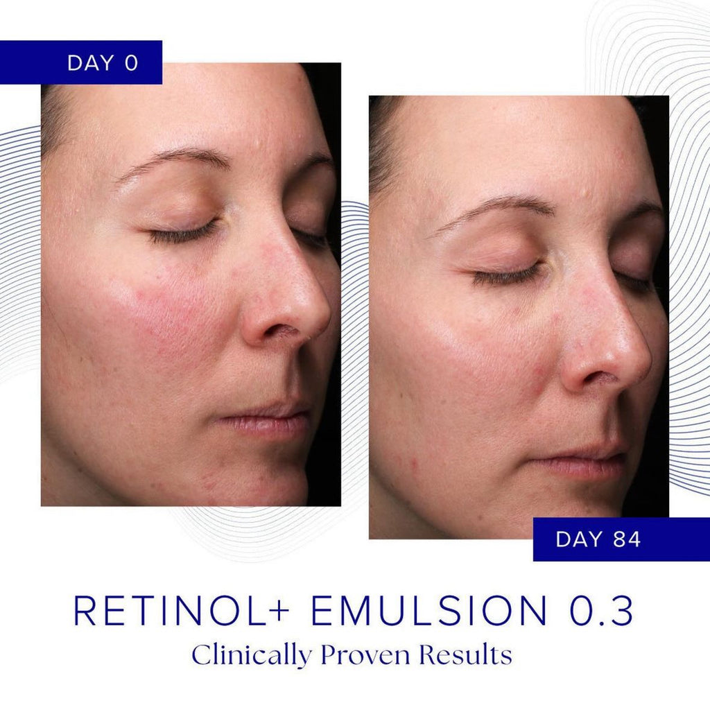 Retinol Is Clinical