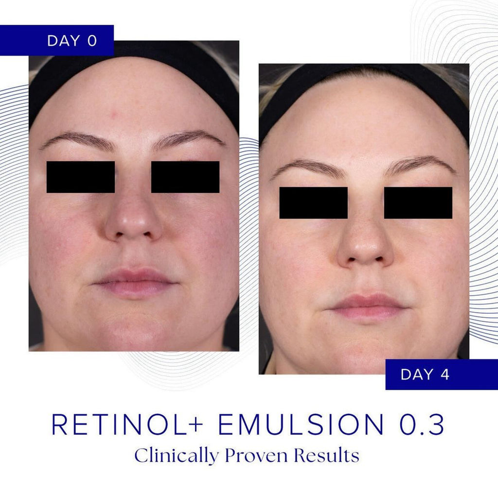 Retinol Is Clinical