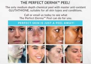 Perfect Derma Peel